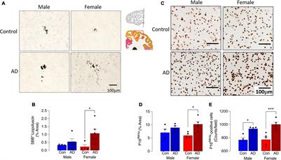 Sex-Related Microglial Perturbation Is Related to Mitochondrial Changes in a Model of Alzheimer’s Disease